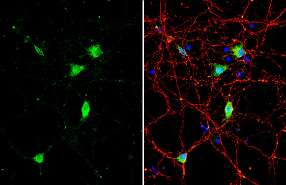 BDNF Antibody in Immunocytochemistry (ICC/IF)