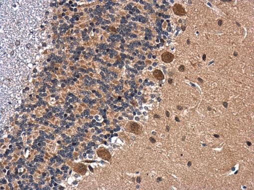 BDNF Antibody in Immunohistochemistry (Paraffin) (IHC (P))