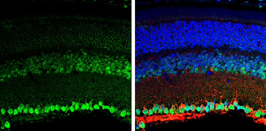 BDNF Antibody in Immunohistochemistry (Paraffin) (IHC (P))