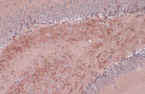 BDNF Antibody in Immunohistochemistry (Paraffin) (IHC (P))