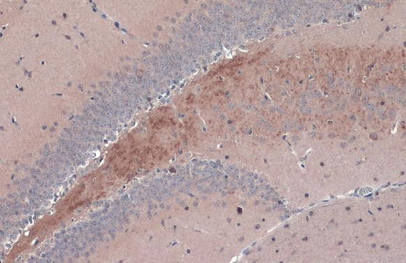 BDNF Antibody in Immunohistochemistry (Paraffin) (IHC (P))