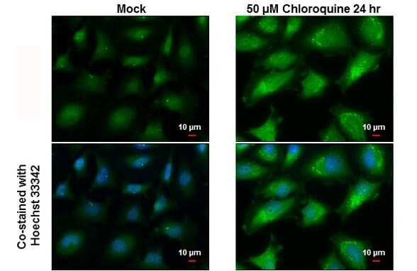 GABARAPL2 Antibody in Immunocytochemistry (ICC/IF)