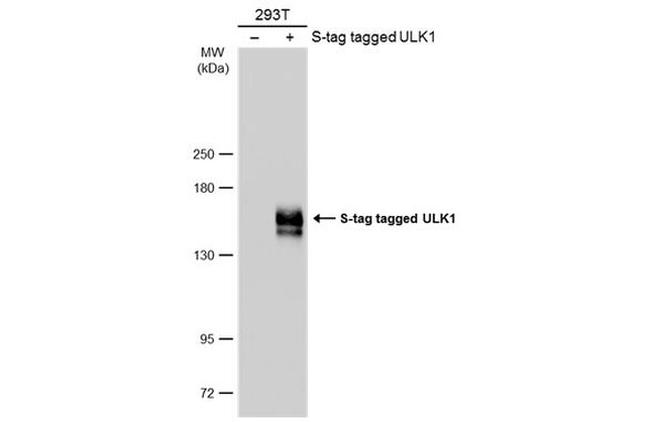 ULK1 Antibody in Western Blot (WB)