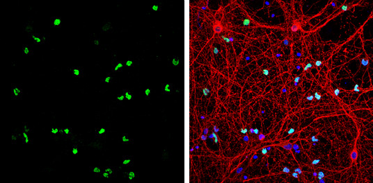 OLIG2 Antibody in Immunocytochemistry (ICC/IF)