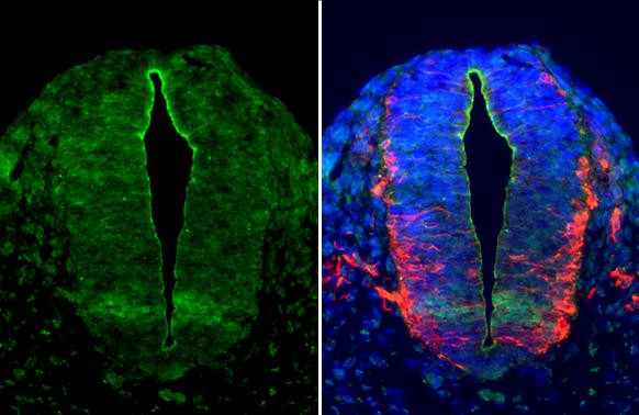 OLIG2 Antibody in Immunohistochemistry (Paraffin) (IHC (P))