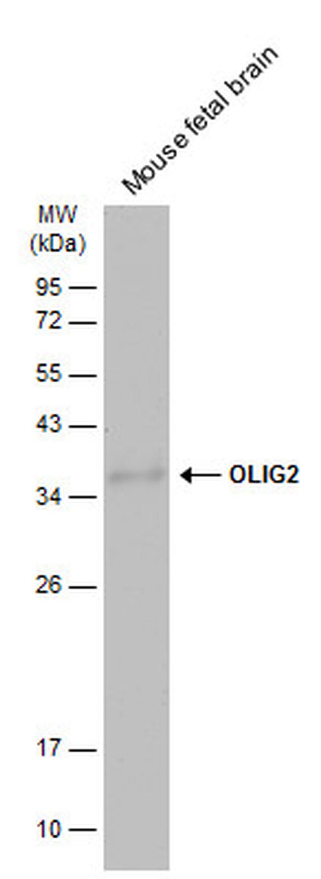 OLIG2 Antibody in Western Blot (WB)