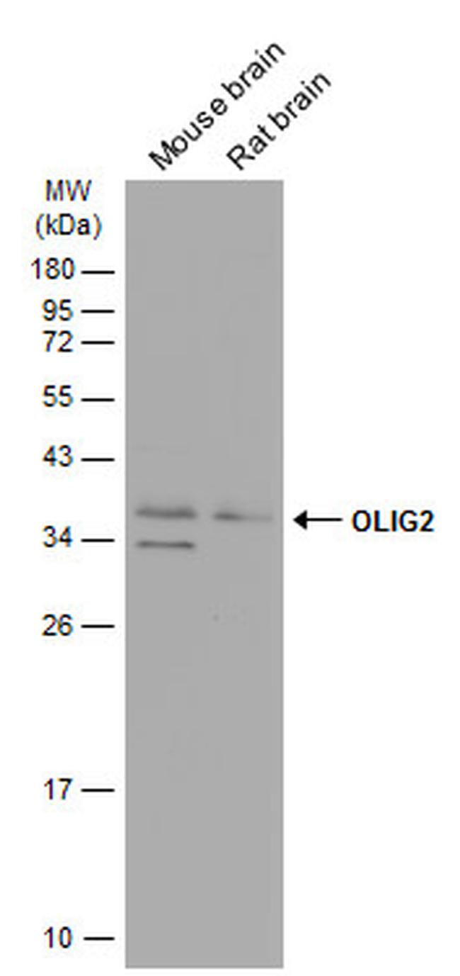 OLIG2 Antibody in Western Blot (WB)