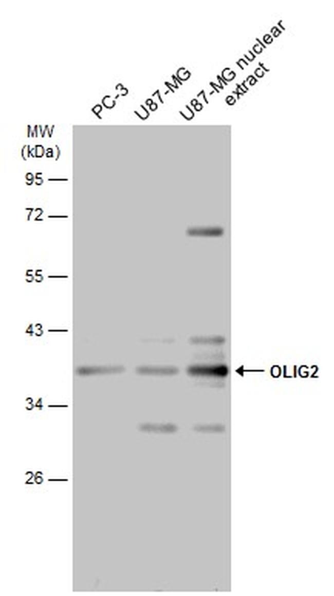 OLIG2 Antibody in Western Blot (WB)