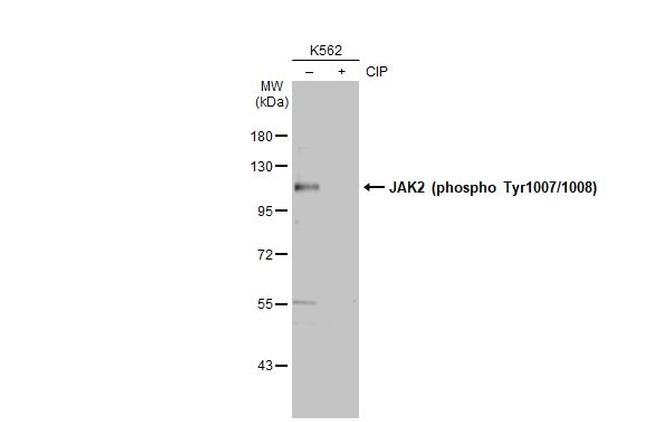 Phospho-JAK2 (Tyr1007, Tyr1008) Antibody in Western Blot (WB)