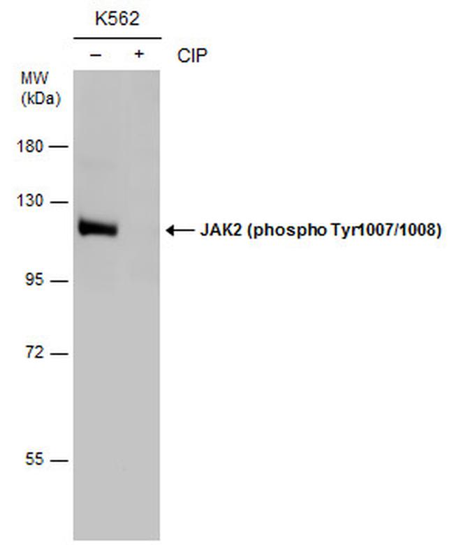 Phospho-JAK2 (Tyr1007, Tyr1008) Antibody in Western Blot (WB)