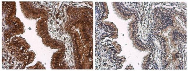 Phospho-mTOR (Ser2448) Antibody in Immunohistochemistry (Paraffin) (IHC (P))