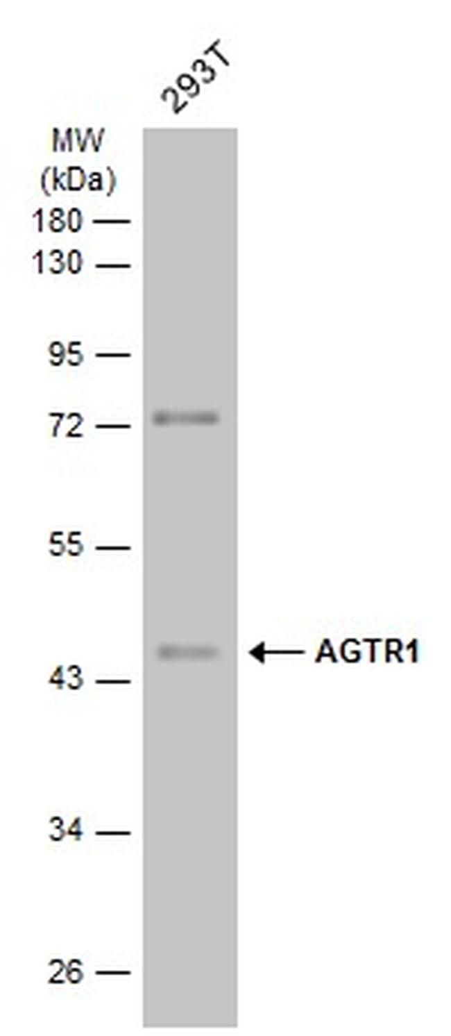 AGTR1 Antibody in Western Blot (WB)