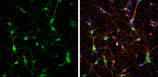 CaMKII beta Antibody in Immunocytochemistry (ICC/IF)