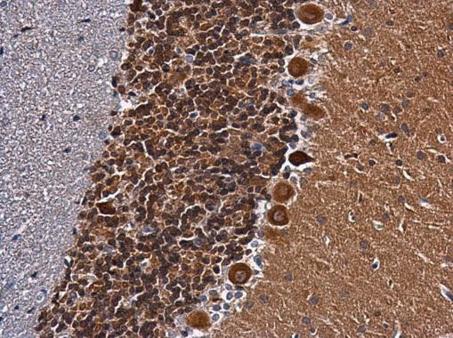 CaMKII beta Antibody in Immunohistochemistry (Paraffin) (IHC (P))