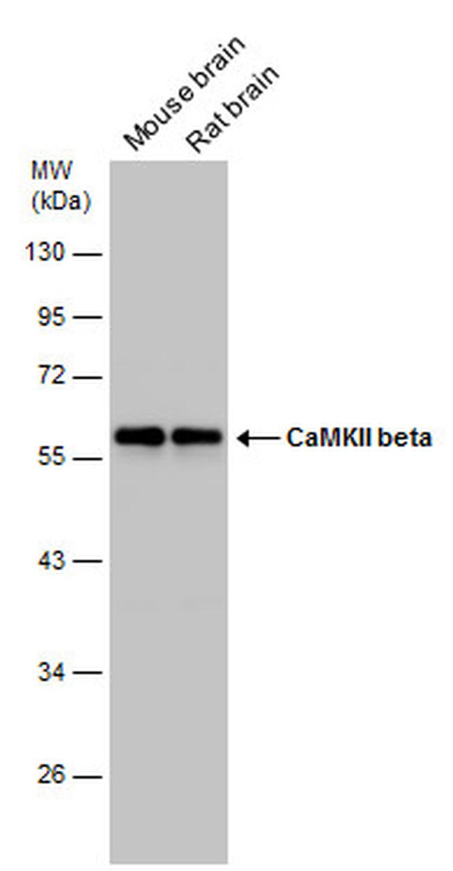 CaMKII beta Antibody in Western Blot (WB)