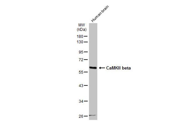 CaMKII beta Antibody in Western Blot (WB)