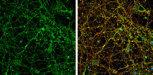 PSD-95 Antibody in Immunocytochemistry (ICC/IF)