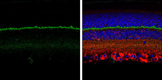 PSD-95 Antibody in Immunohistochemistry (Paraffin) (IHC (P))