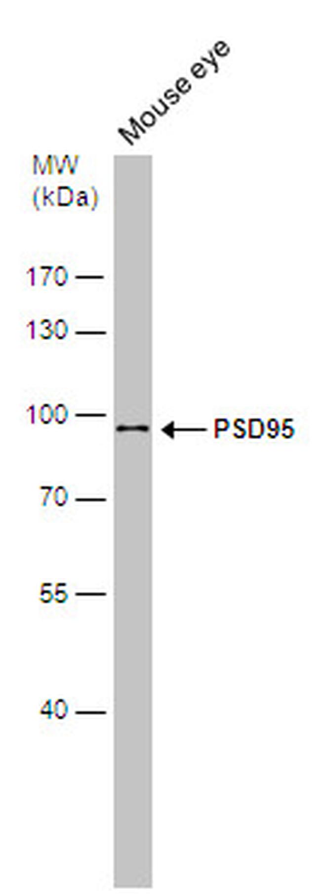 PSD-95 Antibody in Western Blot (WB)