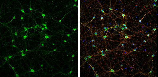 NMDAR1 Antibody in Immunocytochemistry (ICC/IF)