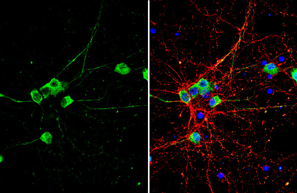 NMDAR1 Antibody in Immunocytochemistry (ICC/IF)