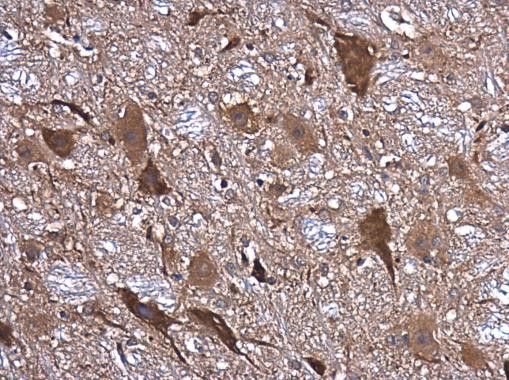 NMDAR1 Antibody in Immunohistochemistry (Paraffin) (IHC (P))