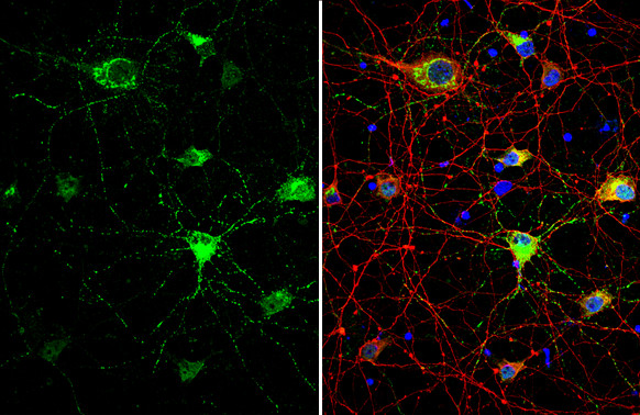 Somatostatin Antibody in Immunocytochemistry (ICC/IF)