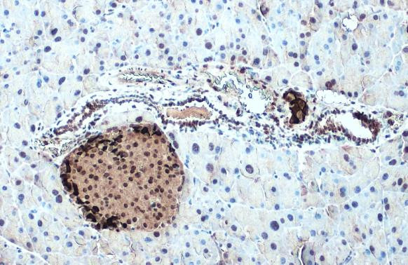 Somatostatin Antibody in Immunohistochemistry (Paraffin) (IHC (P))