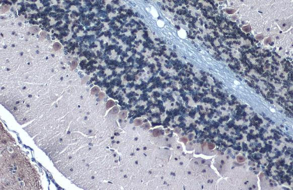 Somatostatin Antibody in Immunohistochemistry (Paraffin) (IHC (P))