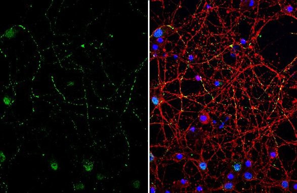 Somatostatin Antibody in Immunocytochemistry (ICC/IF)