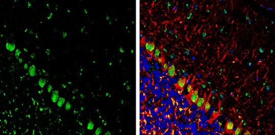 Somatostatin Antibody in Immunohistochemistry (Frozen) (IHC (F))