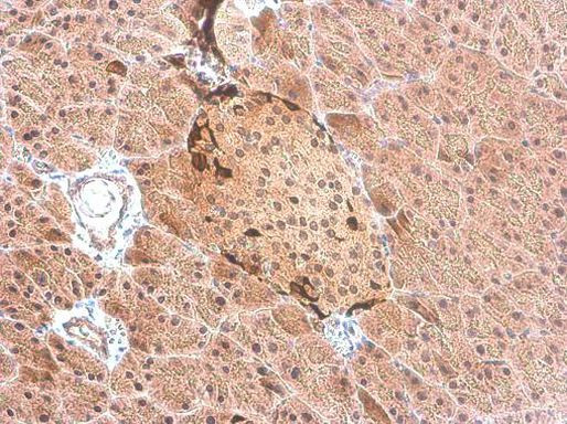 Somatostatin Antibody in Immunohistochemistry (Paraffin) (IHC (P))