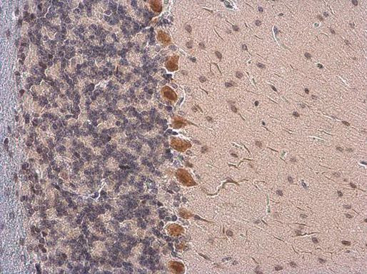 Somatostatin Antibody in Immunohistochemistry (Paraffin) (IHC (P))