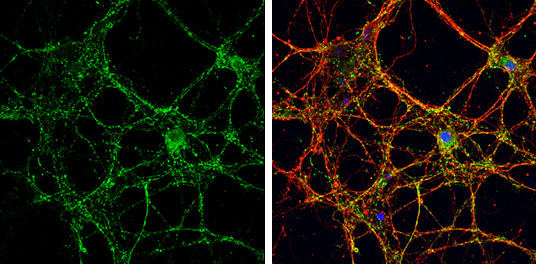 VGLUT1 Antibody in Immunocytochemistry (ICC/IF)