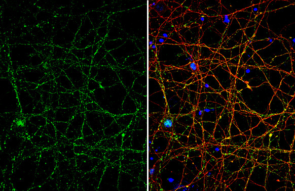 VGLUT1 Antibody in Immunocytochemistry (ICC/IF)