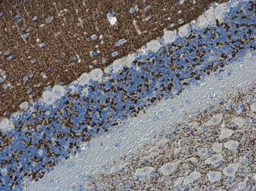 VGLUT1 Antibody in Immunohistochemistry (Paraffin) (IHC (P))