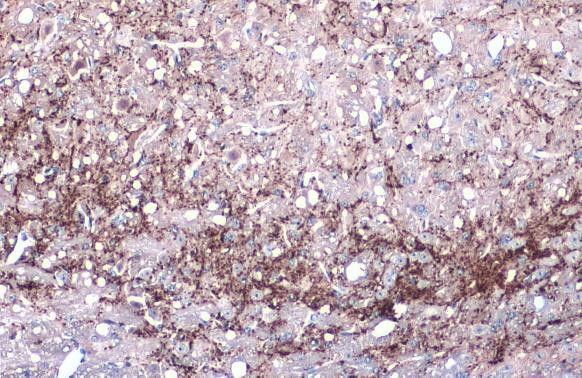 VGLUT1 Antibody in Immunohistochemistry (Paraffin) (IHC (P))