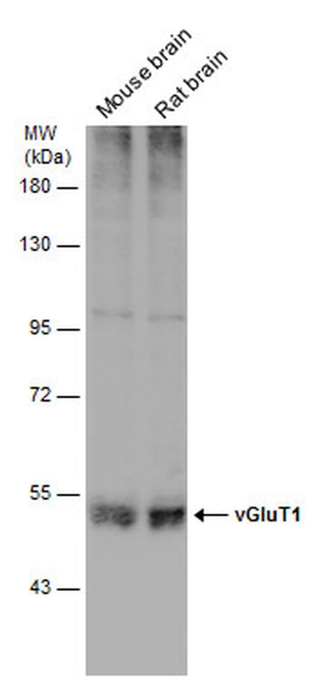 VGLUT1 Antibody in Western Blot (WB)