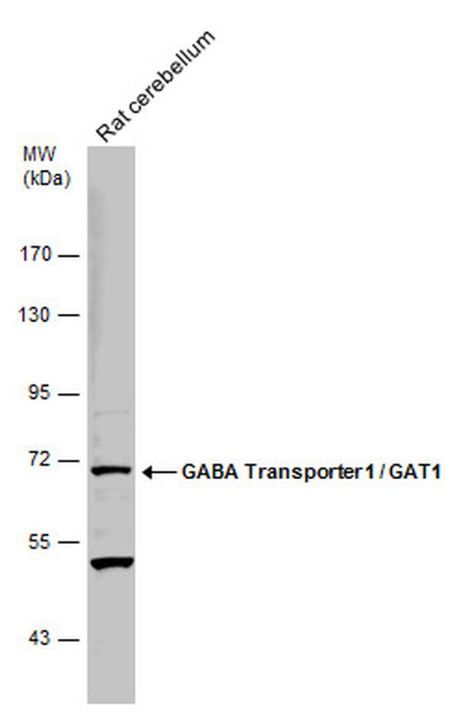 SLC6A1 Antibody in Western Blot (WB)