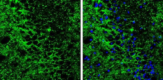 SLC6A1 Antibody in Immunohistochemistry (Frozen) (IHC (F))