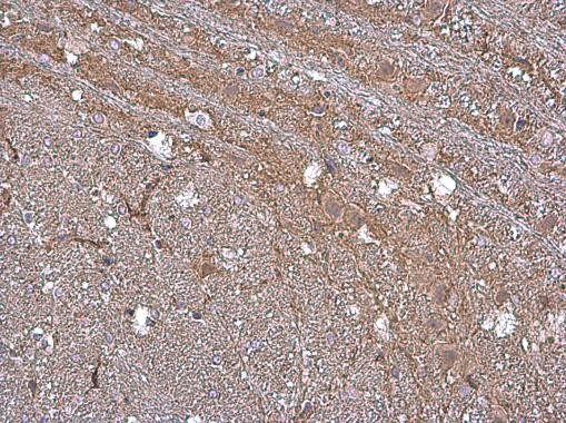 SLC6A1 Antibody in Immunohistochemistry (Paraffin) (IHC (P))