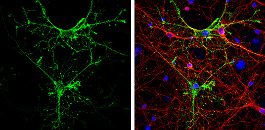 Aquaporin 4 Antibody in Immunocytochemistry (ICC/IF)