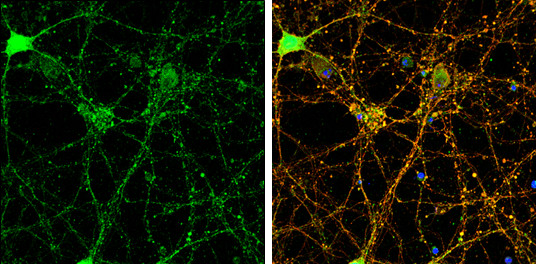 PSD-95 Antibody in Immunocytochemistry (ICC/IF)