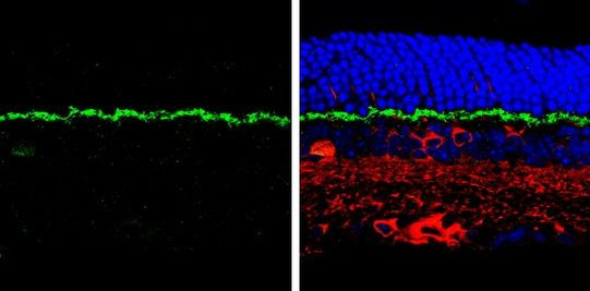 PSD-95 Antibody in Immunohistochemistry (Paraffin) (IHC (P))