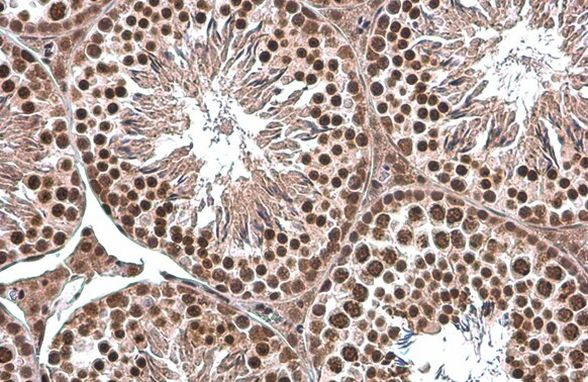 TBP Antibody in Immunohistochemistry (Paraffin) (IHC (P))