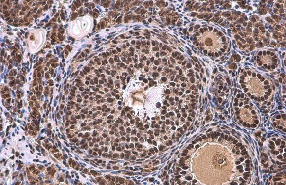 TBP Antibody in Immunohistochemistry (Paraffin) (IHC (P))