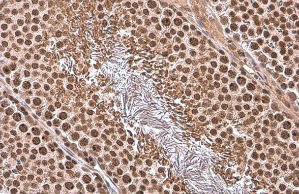 TBP Antibody in Immunohistochemistry (Paraffin) (IHC (P))