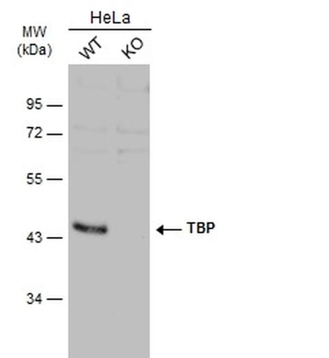 TBP Antibody in Western Blot (WB)