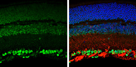 OTX2 Antibody in Immunohistochemistry (Paraffin) (IHC (P))