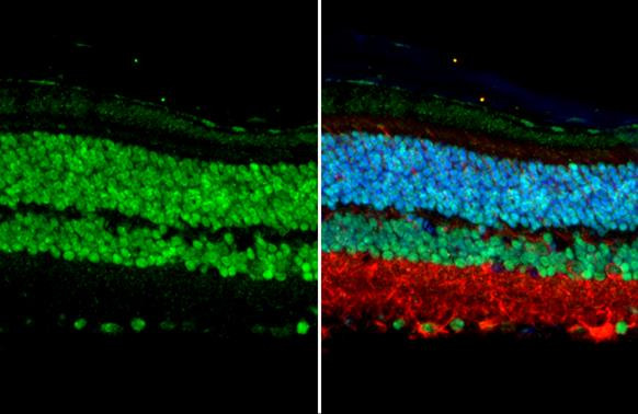 OTX2 Antibody in Immunohistochemistry (Paraffin) (IHC (P))